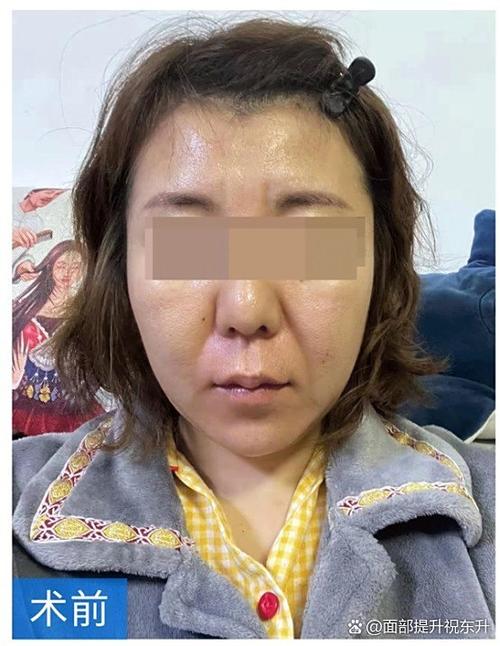 脸上有肉脚背无肉的人命运如何？
