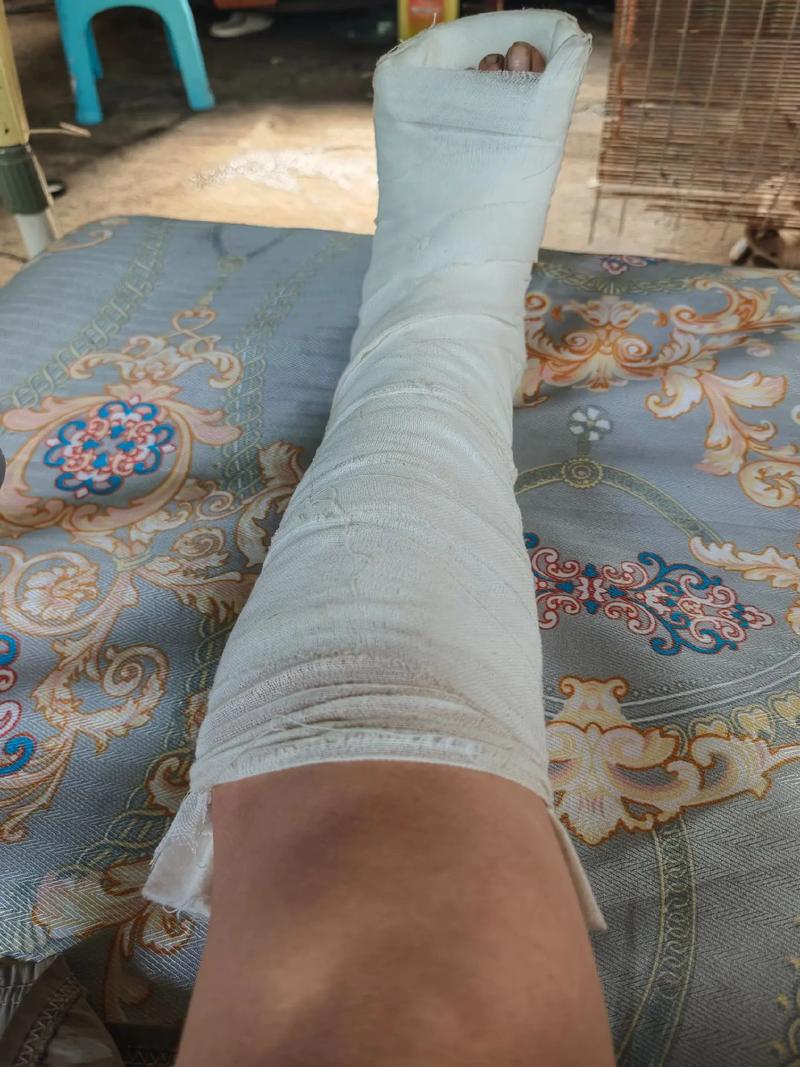 骨折是否与家中的风水布局有关联？