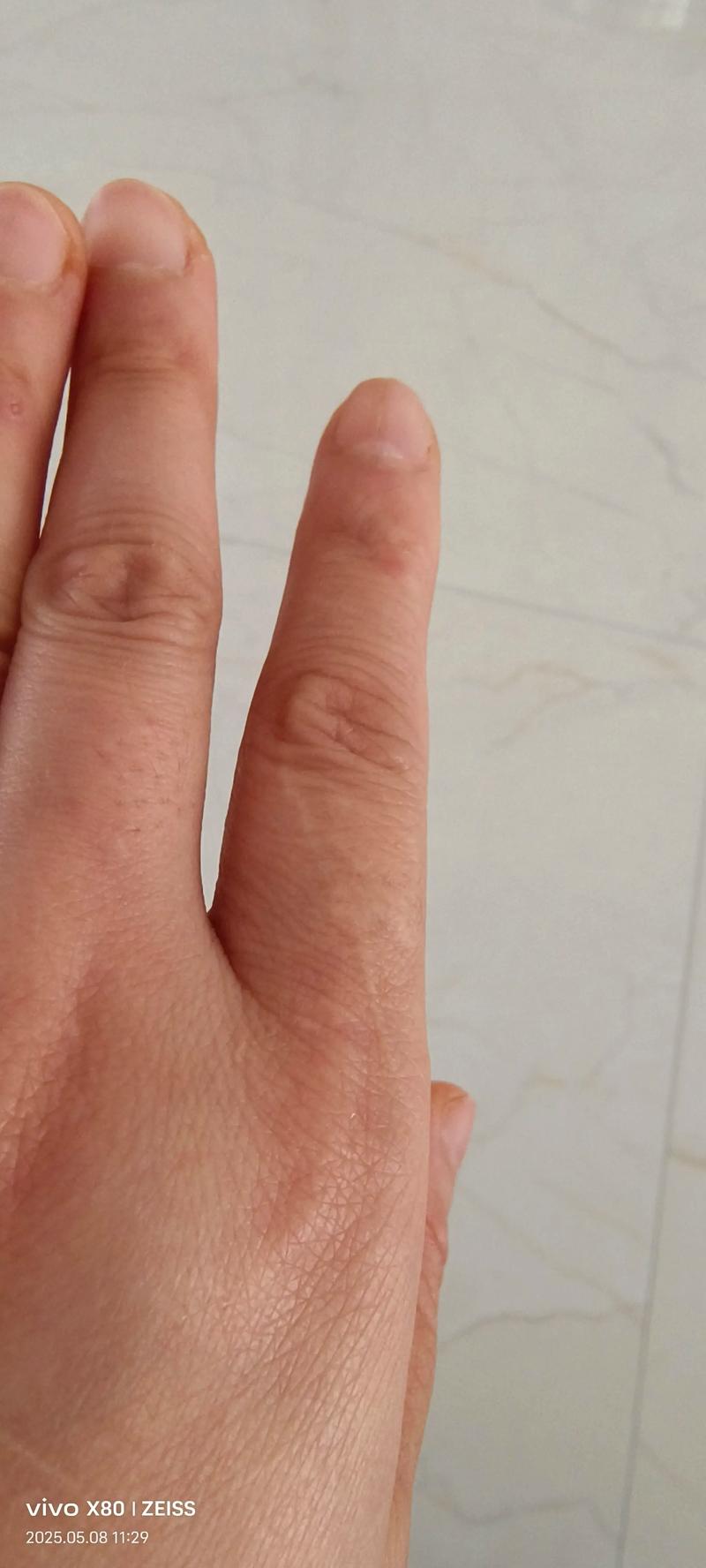 手上有疤的女人命运如何，是何种命格？