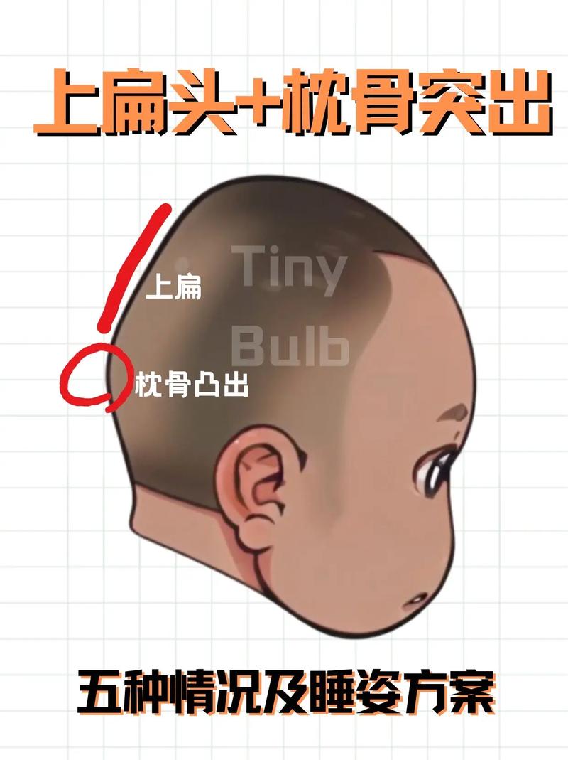 枕骨突出的人命运如何？