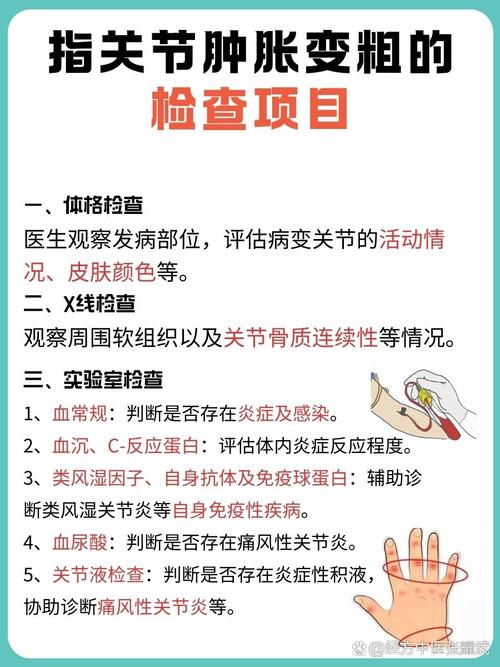 女人手指关节变粗是预示着什么命运？