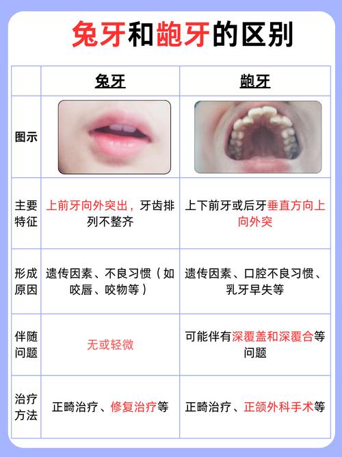 女性暴牙命运如何，民间说法有何解释？