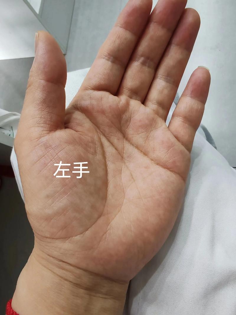 没手纹的人命运如何？手纹粗的女人命运是不是彳艮好？