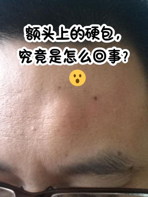 天生头顶硬包是何命运？几月份出生的女孩子天生享福？