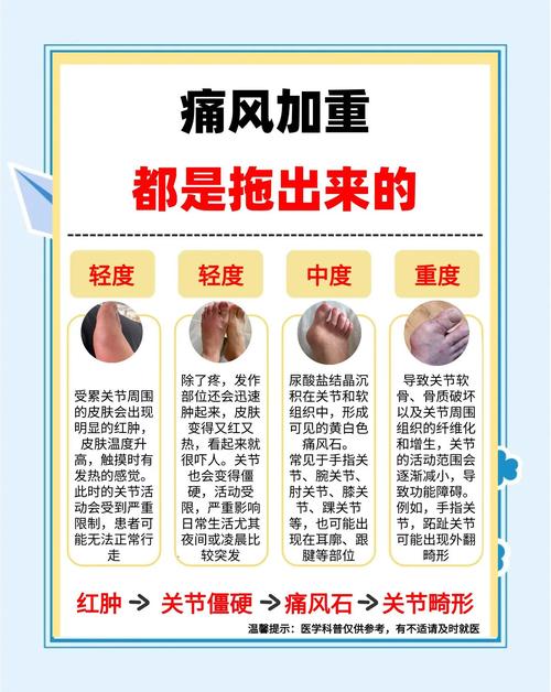 痛风水肿患者能否使用螺内酯来缓解症状？