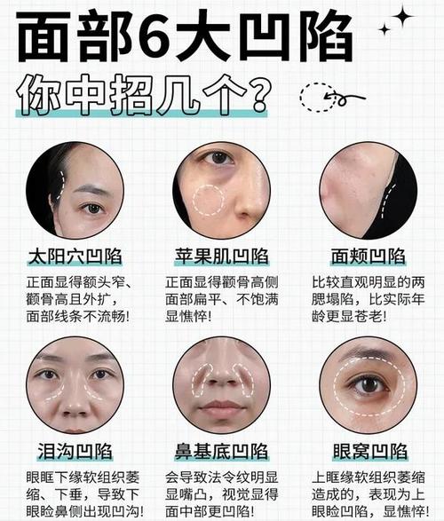 整容脸会对风水产生怎样的影响呢？