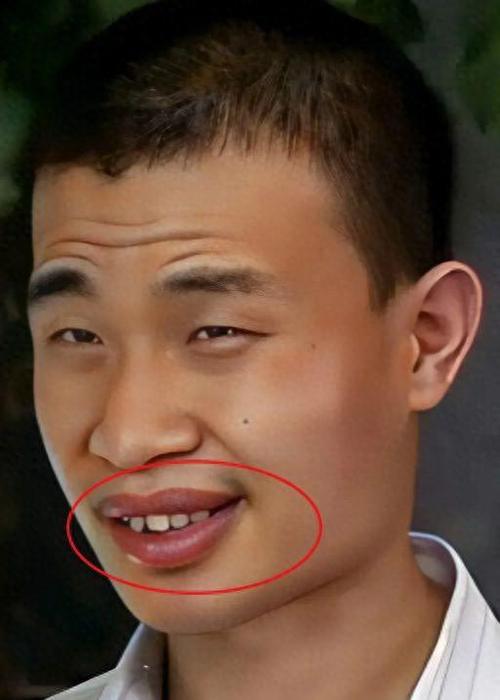 牙齿黄的男人面相是什么命运？