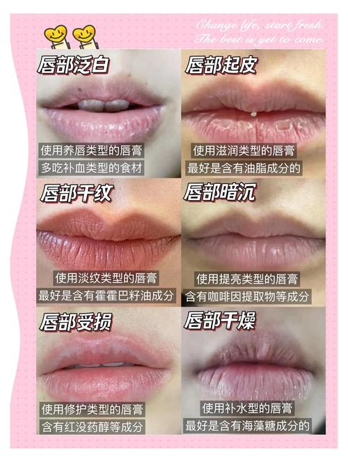 上唇长下唇短，这是不是桃花命呢？