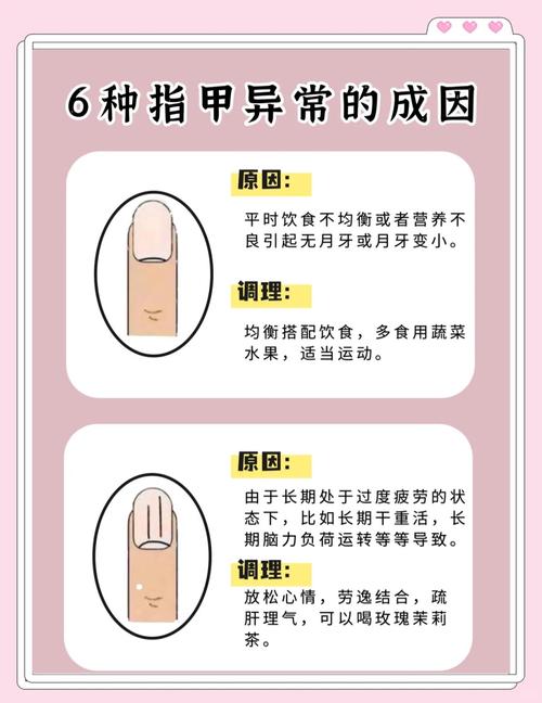 命硬命软分别指什么指甲硬的人命运是否可改变？