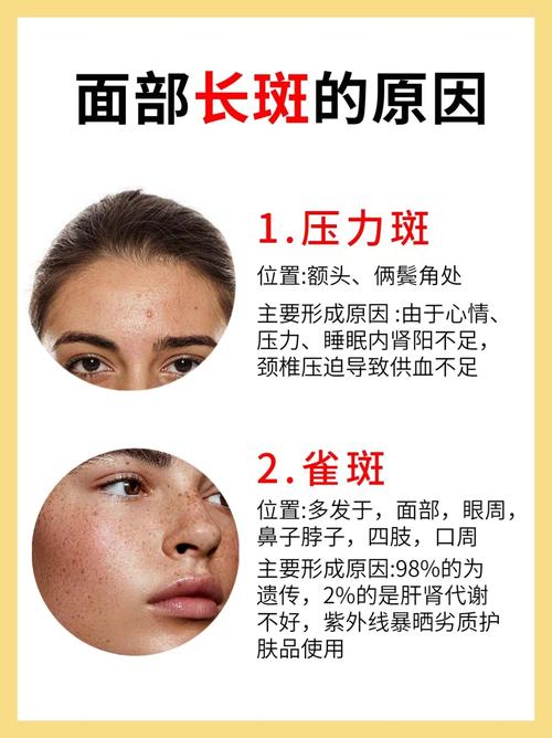 脸上雀斑会对家宅风水产生怎样的影响？