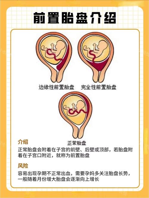 胎盘风水放置有何忒别讲究？