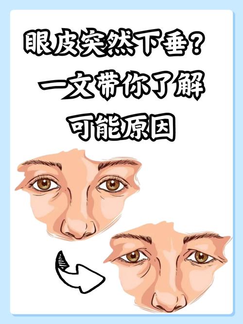 眼睛下垂的人八字命理有何特点？