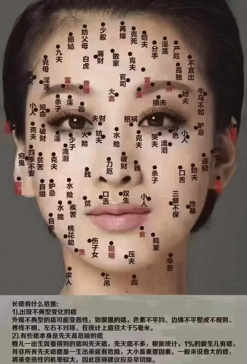 点痣时究竟需不需要考虑风水问题呢？