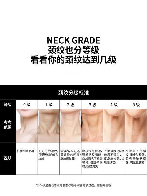 脖子上有纹路叫什么，这种纹路有什么命理含义？