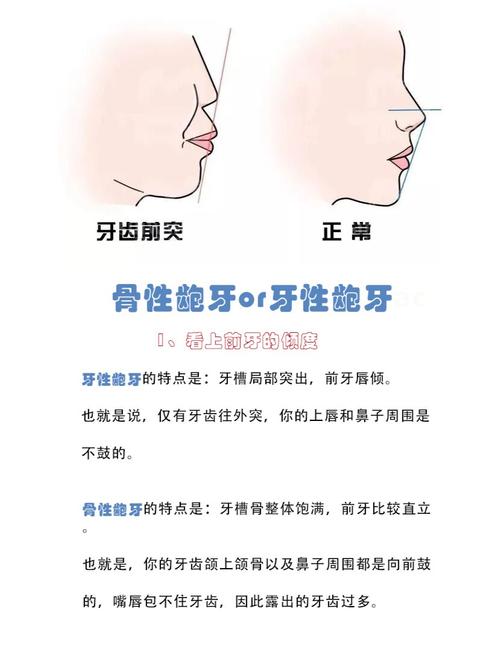 女性暴牙命运如何，民间说法有何解释？