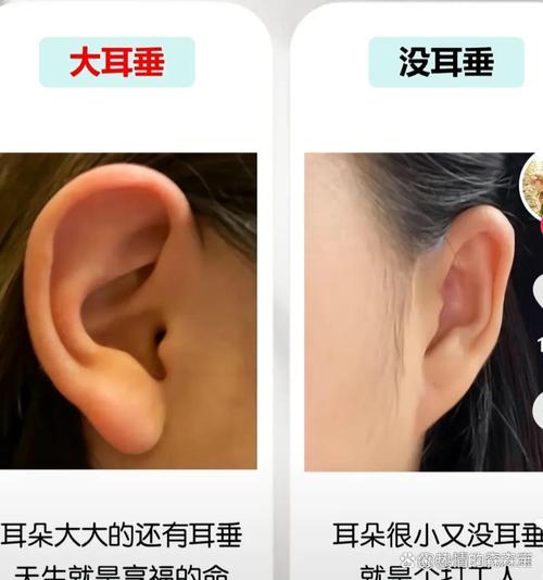 耳垂延伸往下是何命？耳垂无肉命运如何？