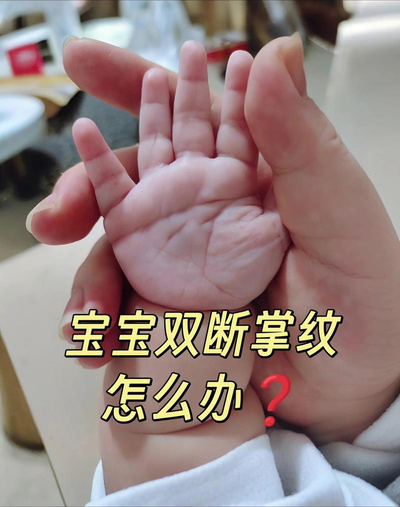 女婴双手断掌命运如何，有何命理影响？