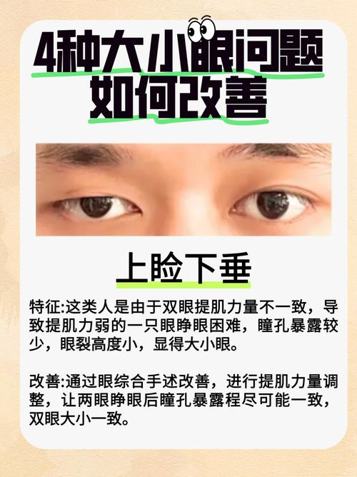 眼睛一大一小会对家居风水产生怎样的影响？