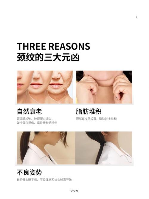 脖子上有纹路叫什么这种纹路有什么命理含义？