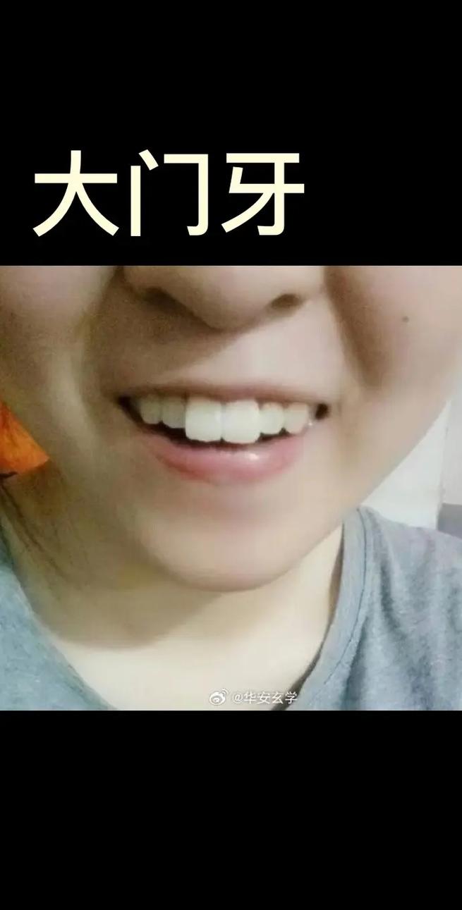 门牙特大或两个门牙大的人命运如何，有何特殊寓意？