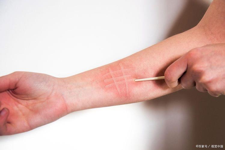 手臂划伤对家居风水有影响吗？