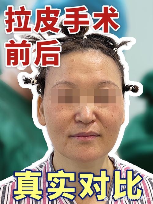 哪些命格的女生不适合进行整容手术？