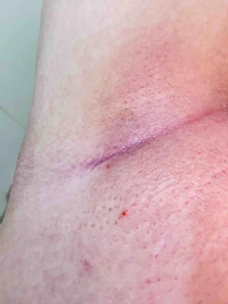 脱腋毛对风水有影响吗？男性做这件事会有什么后果？