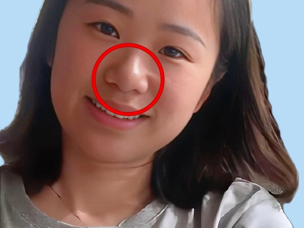 悬胆鼻的女人命运如何？真正的悬胆鼻特征有哪些？