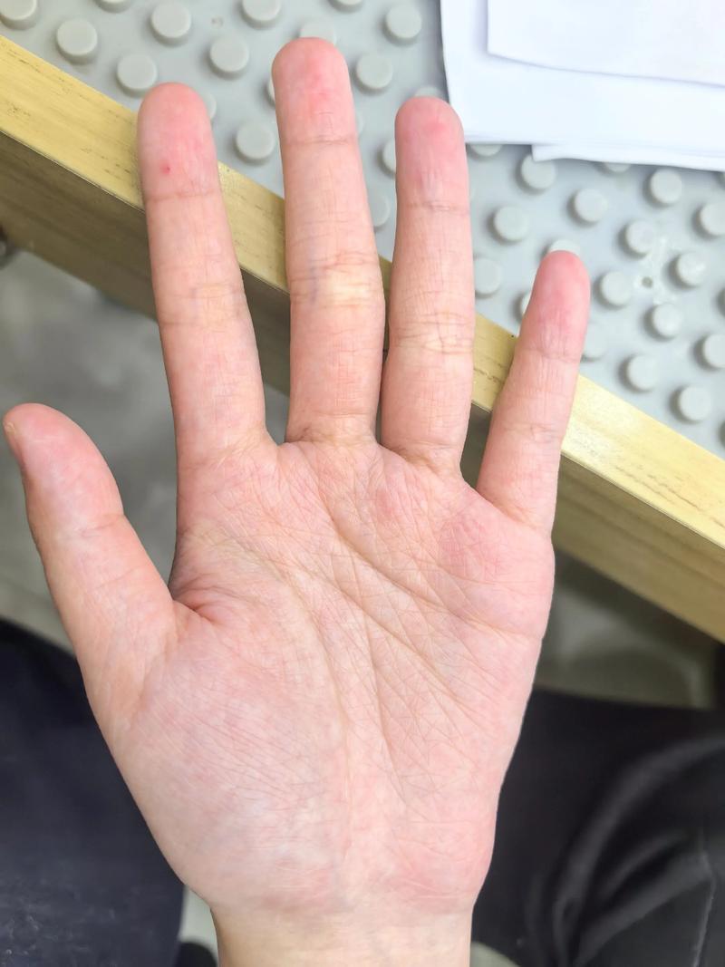 手掌纹路多且杂乱，这是否意味着命运多波折？