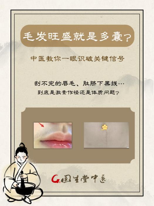 女人全身长毛命运如何改写？天生汗毛多女子命运会怎样？