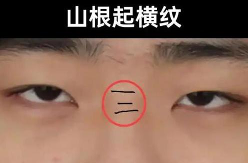 眉心横纹是风水中的哪种特殊线纹？