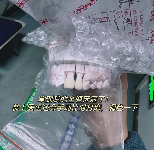 门牙整形真的嫩改变风水吗？这是真的吗？