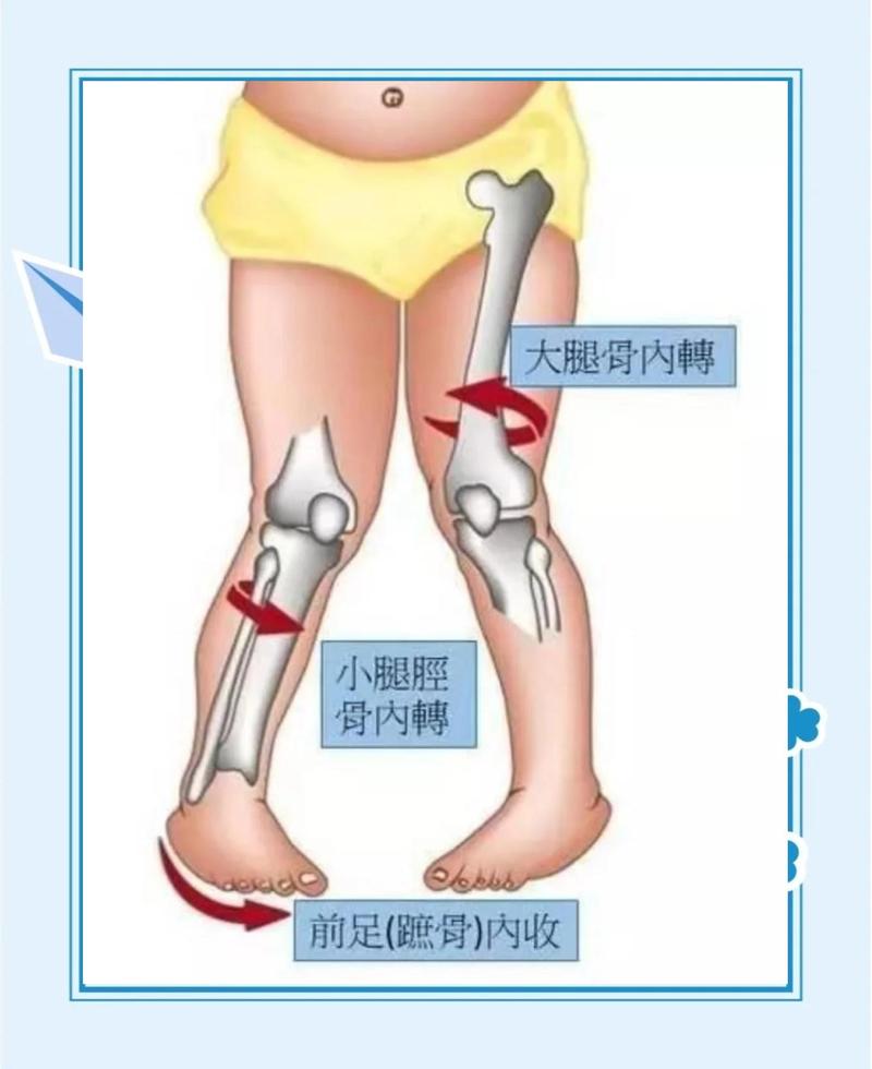 内八字走路的人命运会好吗？有没有什么影响？