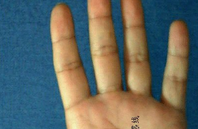 麻衣掌纹、流年掌纹案例详解、掌纹流年运程凶吉案例解读