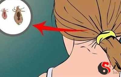 梦见头顶许多虫子