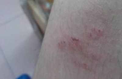 梦见老鼠咬了自己的手