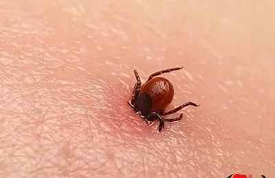 梦见虫子钻进皮肤