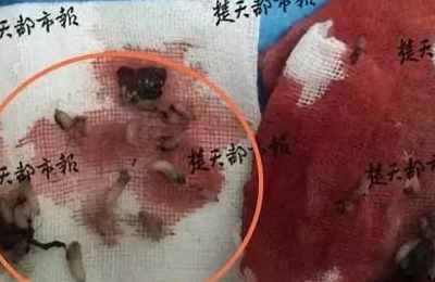 梦见从自己肉里拽出蛆