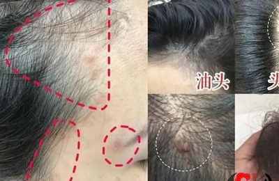 梦见鬼剥人的头皮