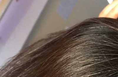 梦见自己头顶没头发