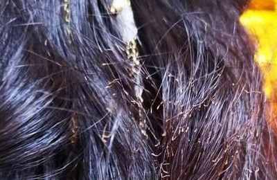 梦见头发被火烧