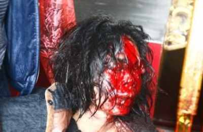 梦见被雷劈受伤